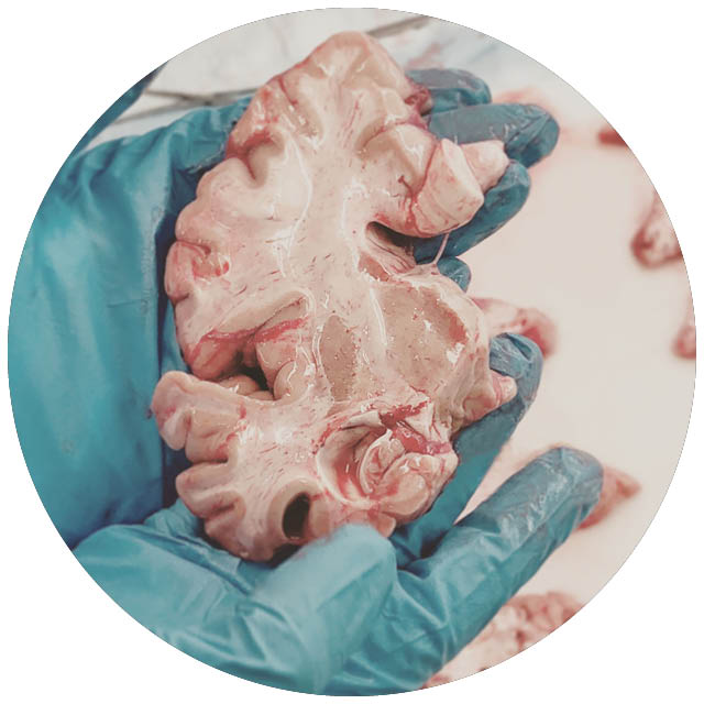 A photo shows a slice from a brain.