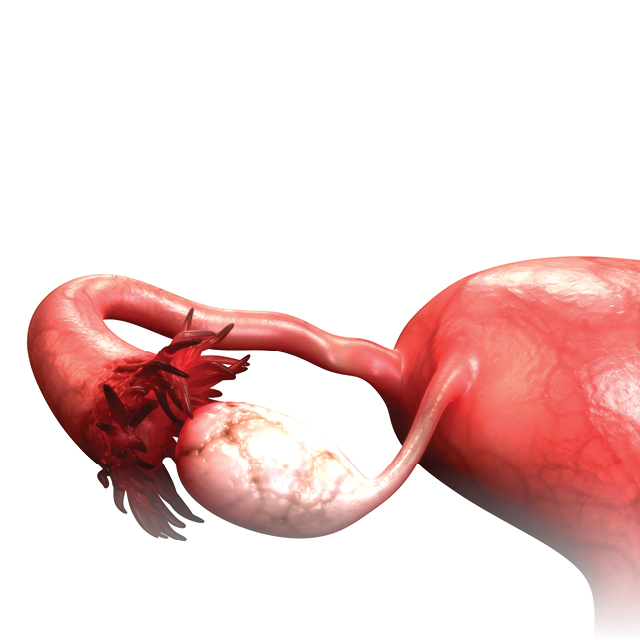 A graphic shows the women's reproductive system.