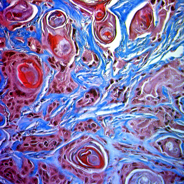 Histopath photo