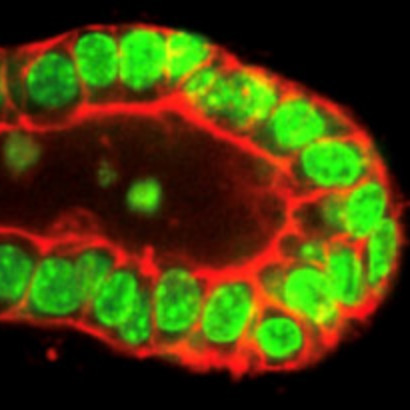 myoepithelial cells in the breast
