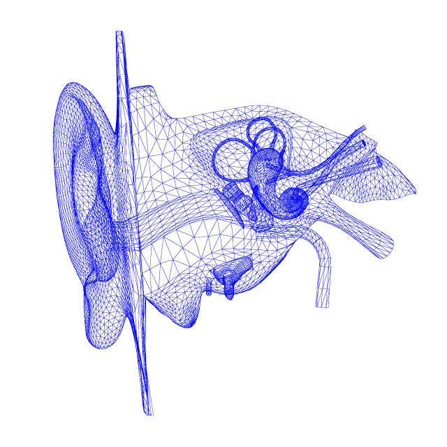 cochlear-implants-640