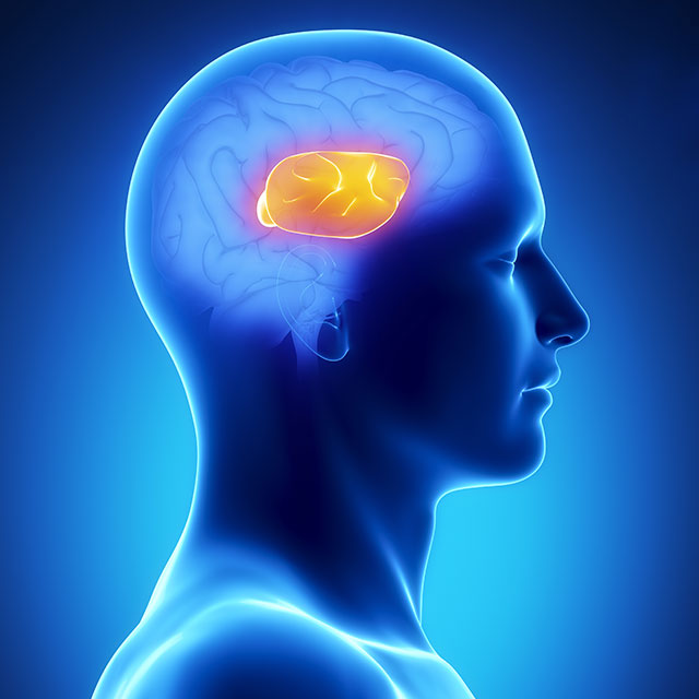 An image shows the where the corpus callosum is located.
