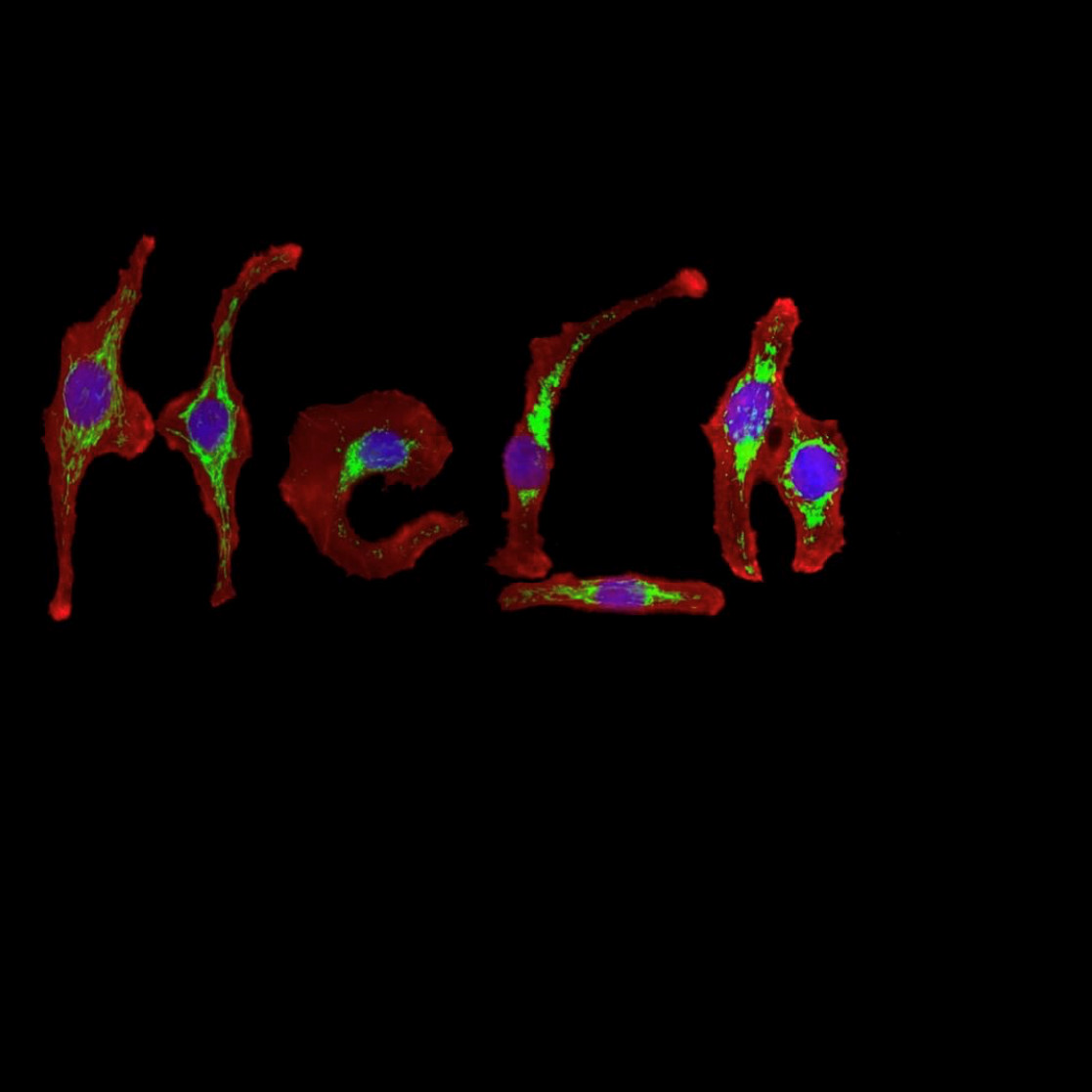 HeLa cells