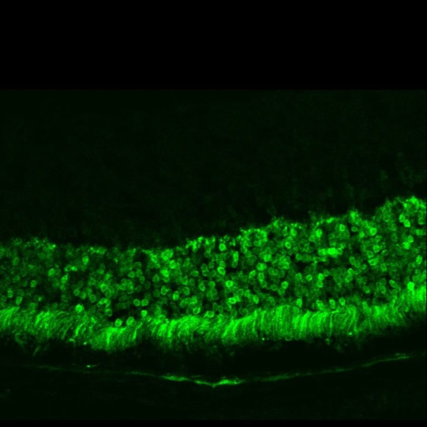 glowing cells in a rat retina