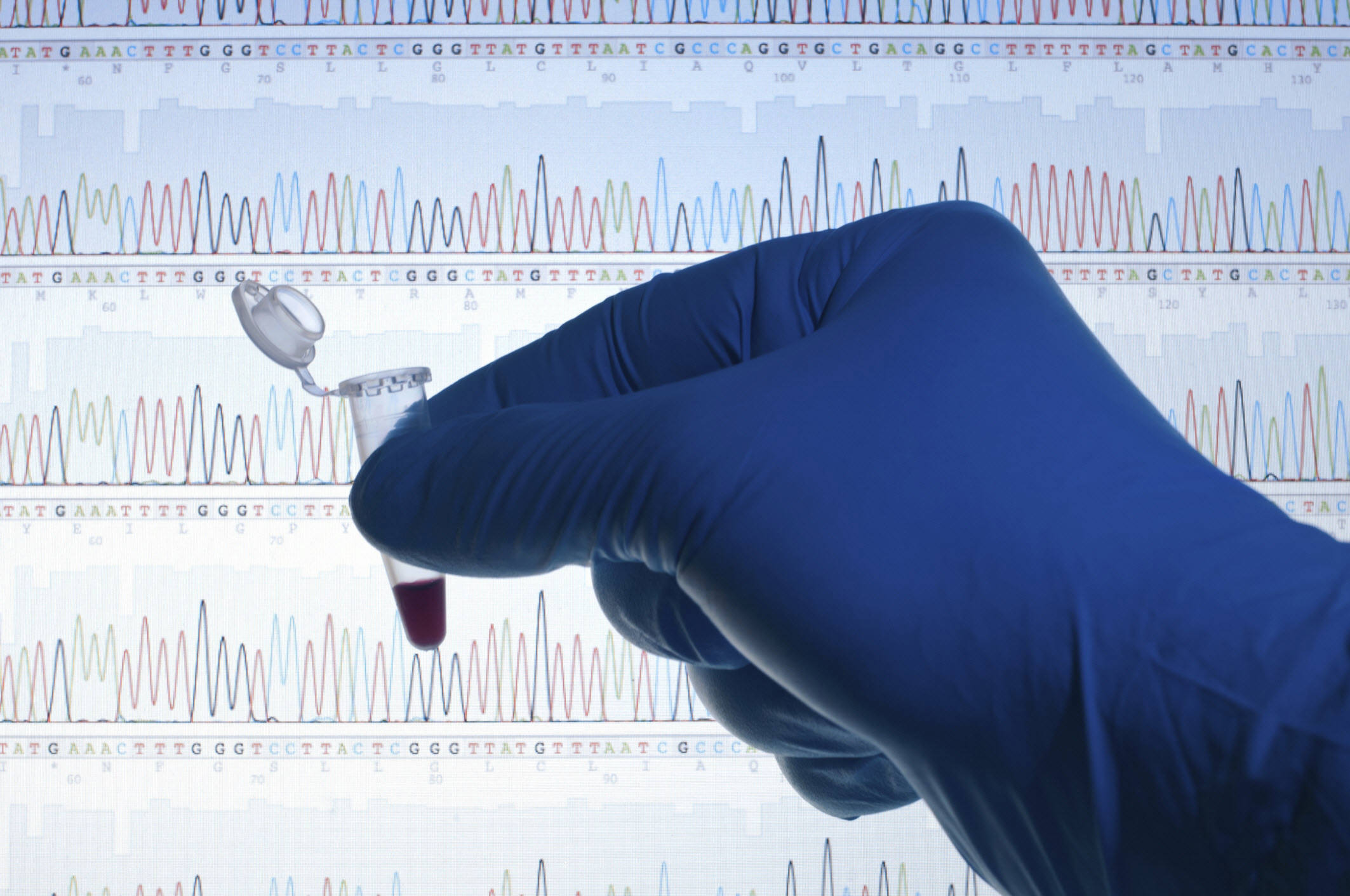 Biomarkers