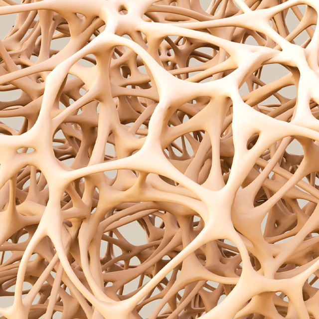 An illustration shows the structure of bone.