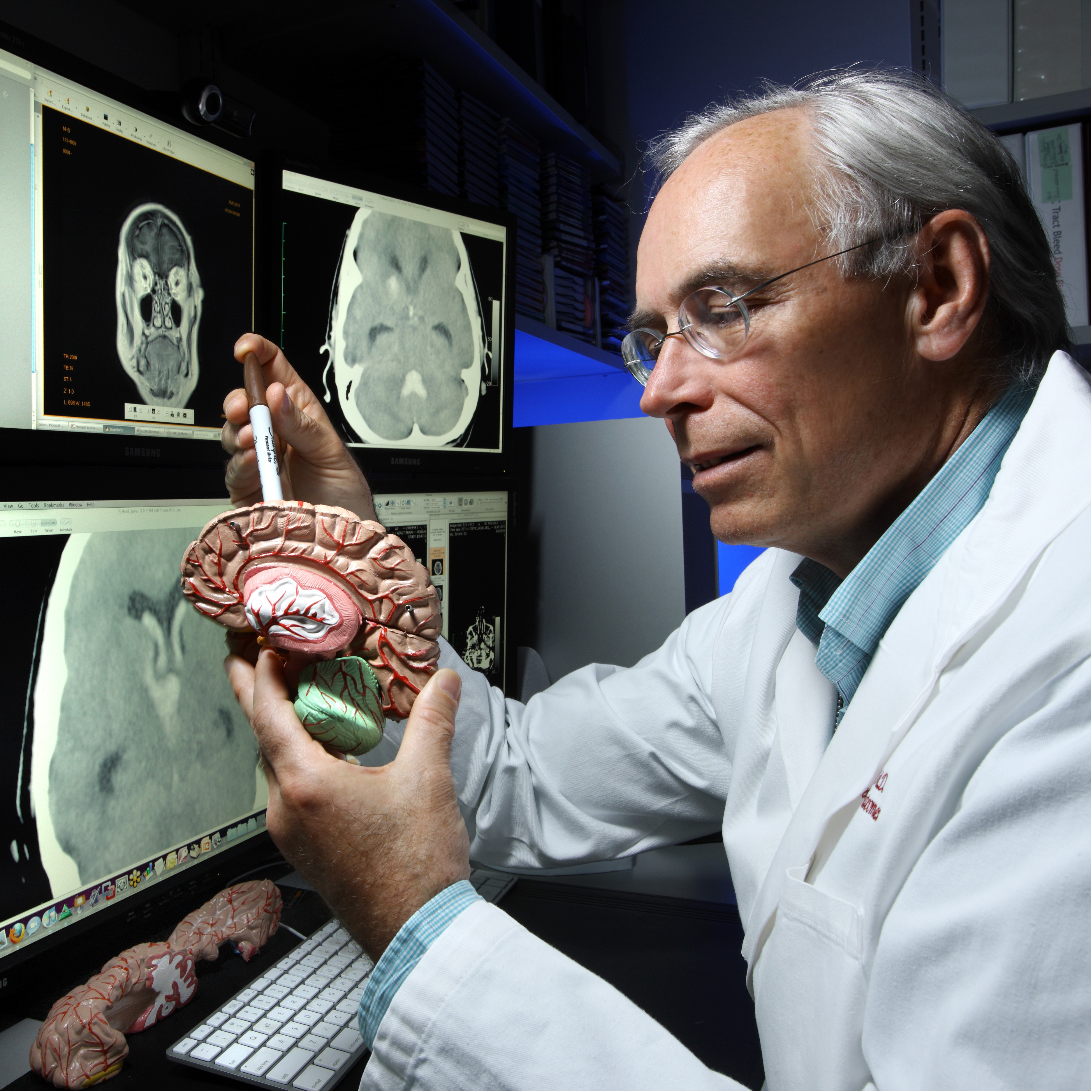 Dr. Daniel Hanley holds a plastic brain model while facing computer monitors displaying brain images.