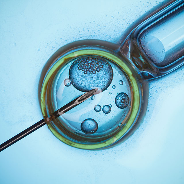 A rendering of in vitro fertilization shows a black needle puncturing a round egg being held in a circular device on a blue background.