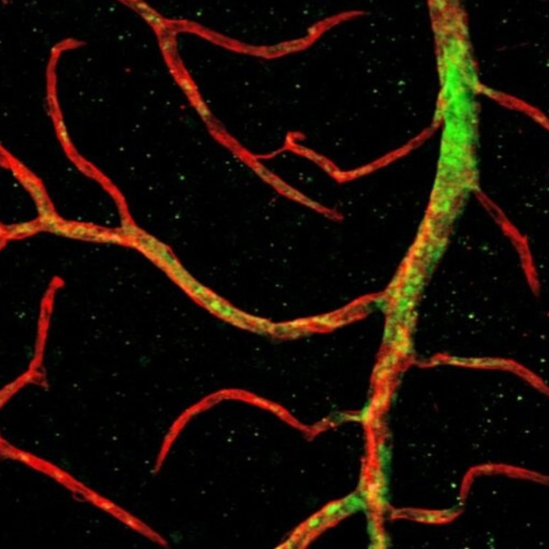 Stem cells repair blood vessels in the eye