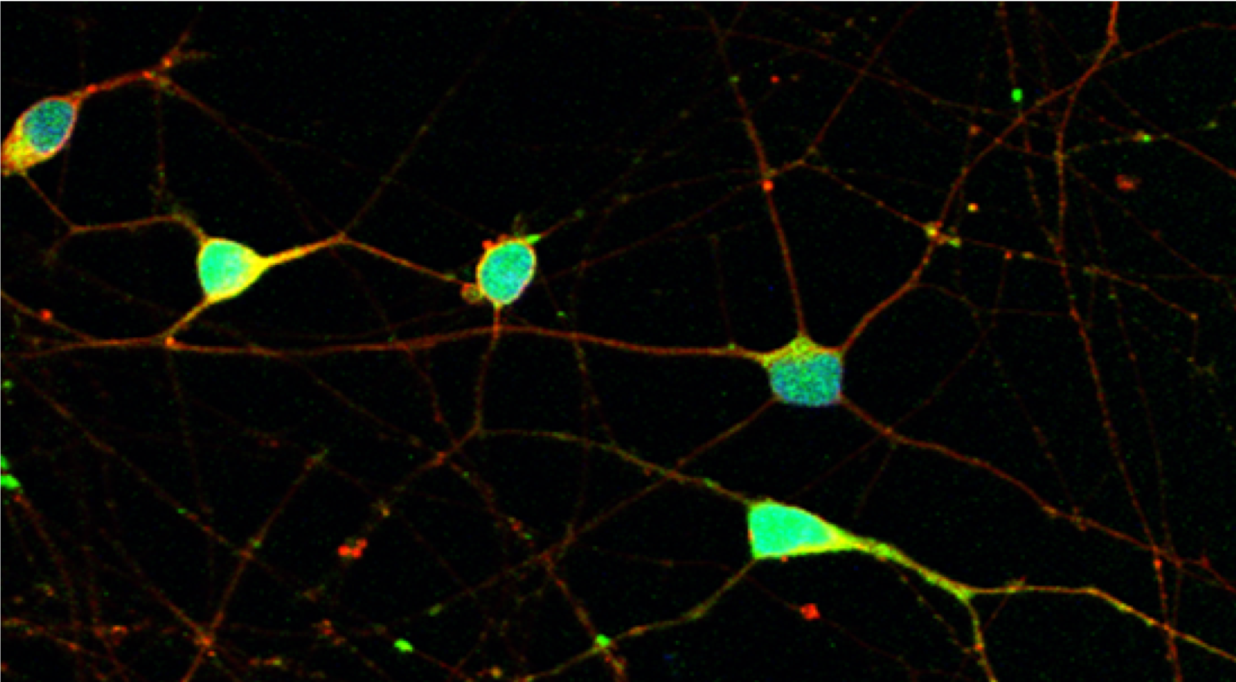 Human stem cells differentiated into retinal ganglion cells (RGCs).
