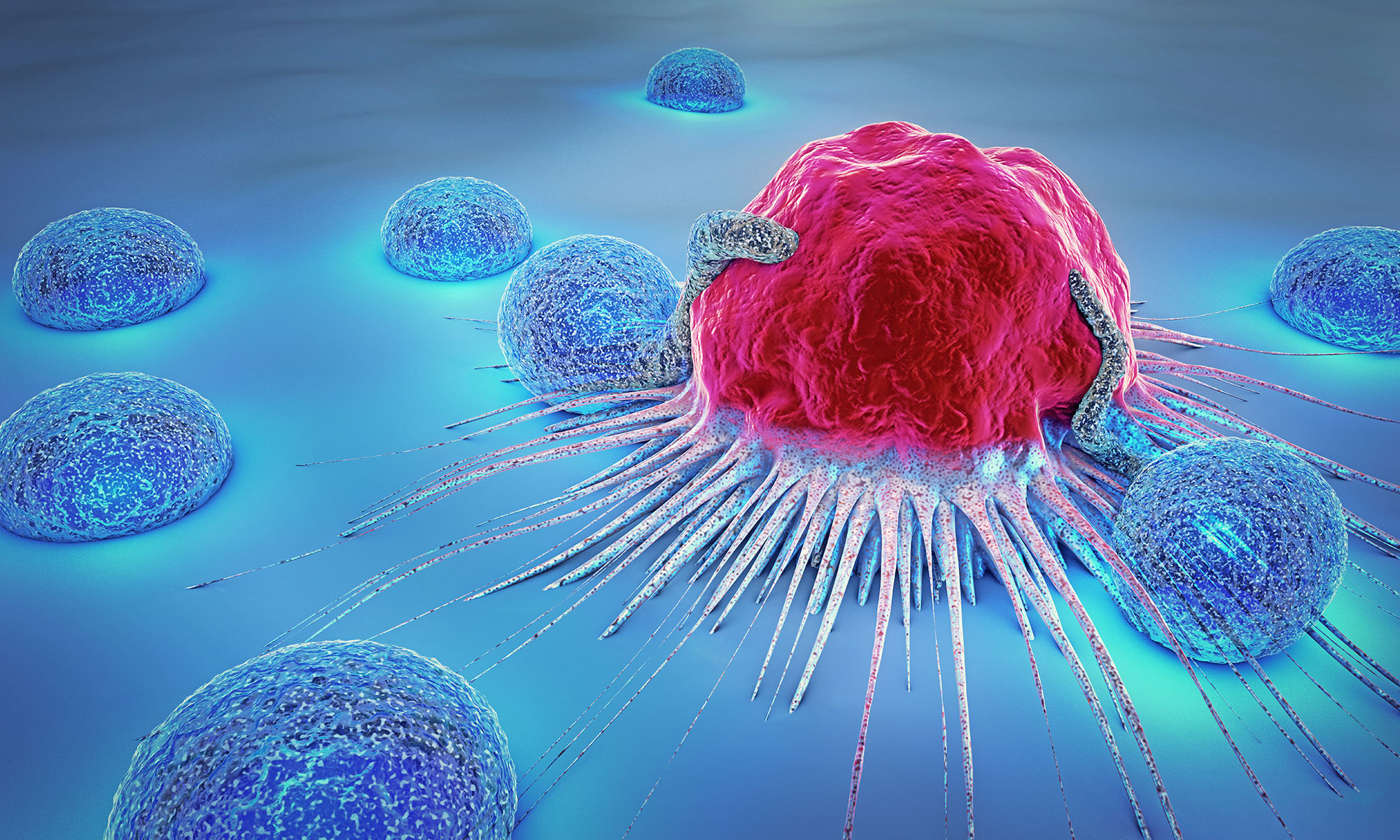 3D artist's rendering of tumor shown in red on ice-blue background. 