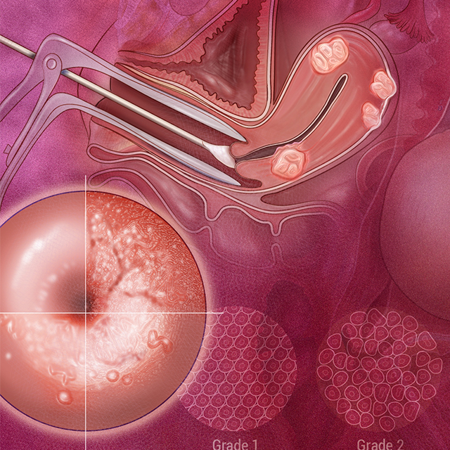 A collage of gynecology and obstetrics images features uterine fibroids, a pap smear, cervical cancer screening, breast cancer screening, ovarian cysts, endometriosis, and a baby.