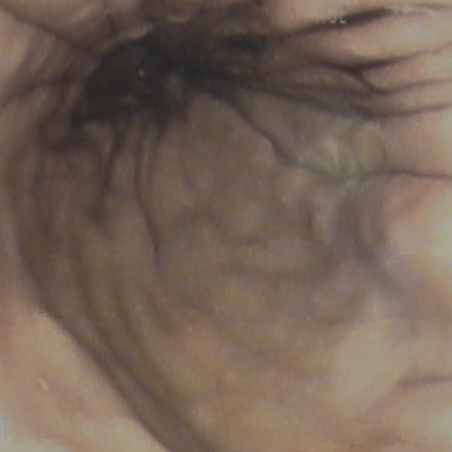 An image from TNE shows the stomach.