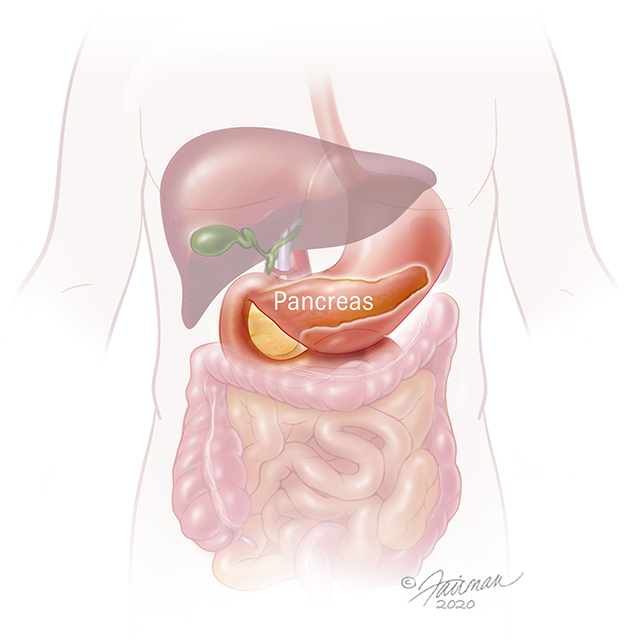 An illustration shows the pancreas.