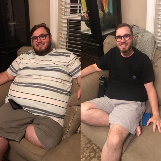 Quentin Hart, before and after bariatric surgery. In both pictures, he is sitting on a couch, wearing shorts and a t-shirt, with a smile, a beard and eyeglasses. 