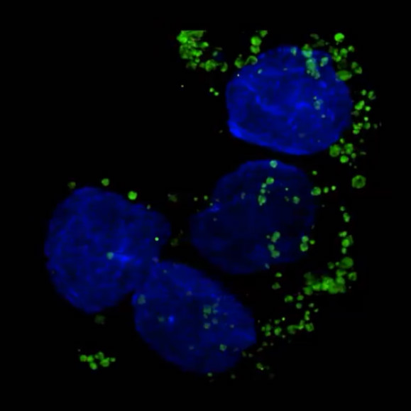 Microscope image of small lime green dots surrounding larger roughly spherical blue shapes. The green dots in this image are the nanodrugs that have entered human colon cancer cells and moved toward blue-dyed nuclei.