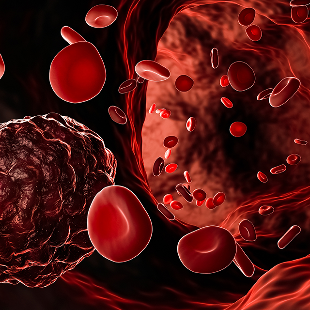 Image depicts cancer cell and red blood cells in blood vessel. 
