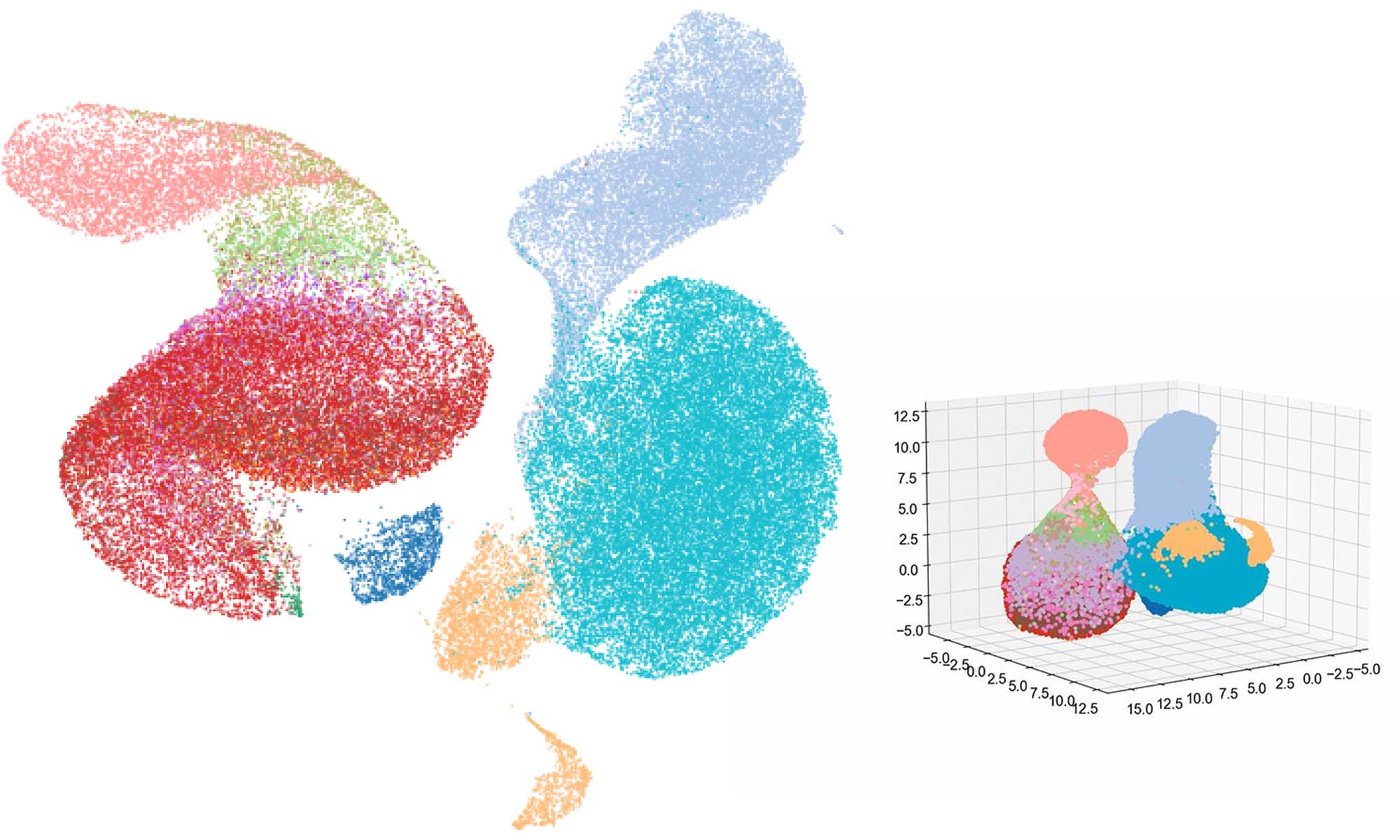 Illustration shows pancreatic cancer concept.