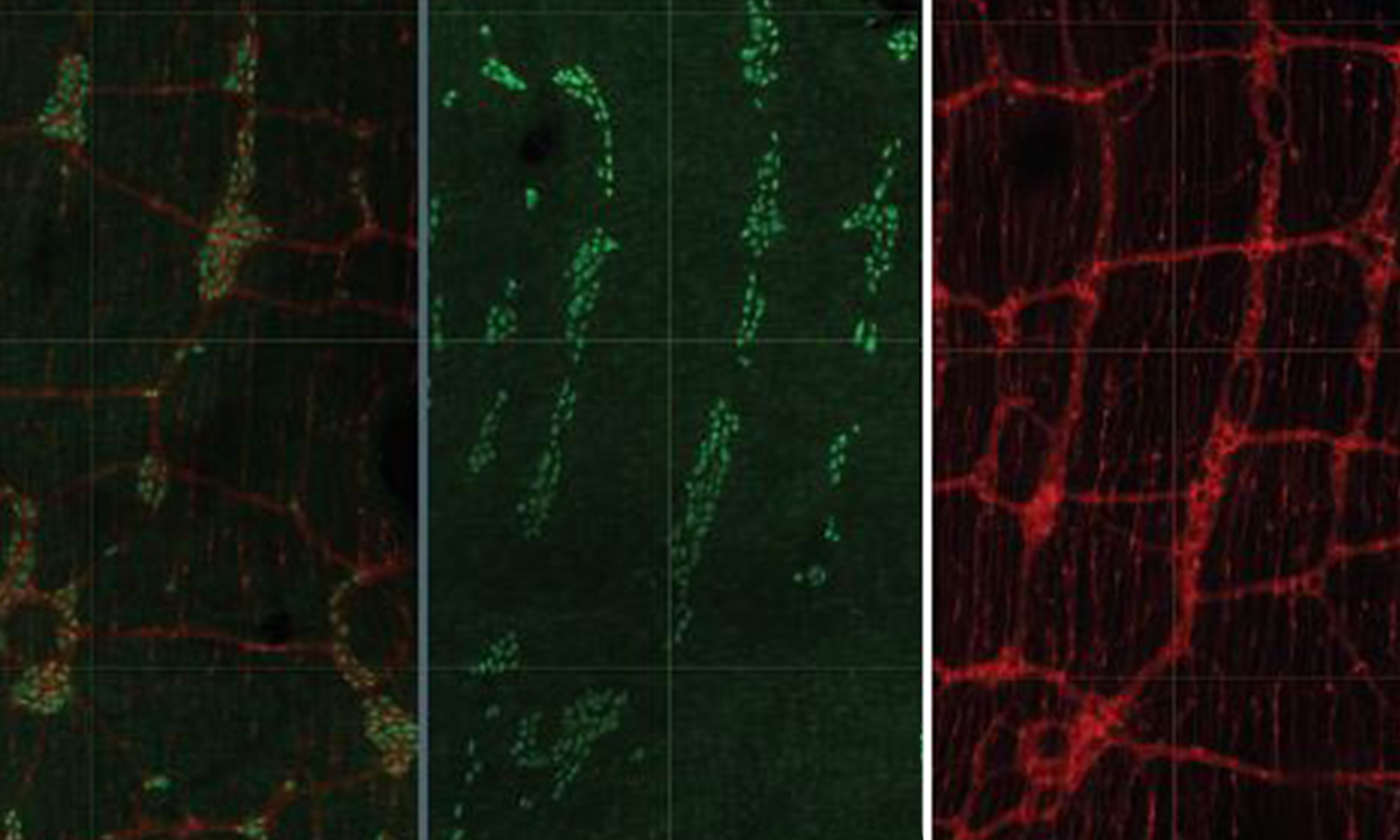 Photos showing meshlike framework of neurons