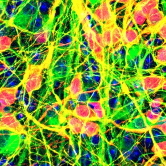 Microscopic image of human stem cell derived RGCs (red) are seen intermingled with endogenous RGCs (green) within a mouse retina, following transplantation.