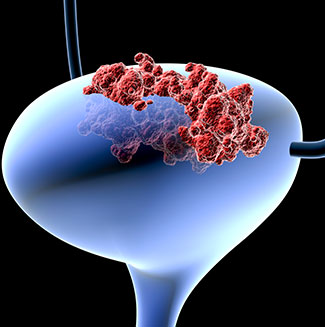 Men and Women Respond Differently to Immune Checkpoint Blockade