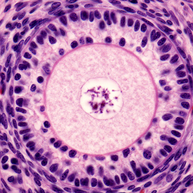 A light microscope micrograph of an ovary. Primary follicle with a big round ovocyte surrounded by the zona pellucida and two layers of granulosa cells