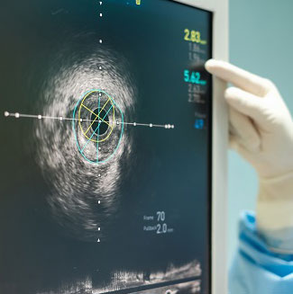 Ultrasound and Testicular Tumors