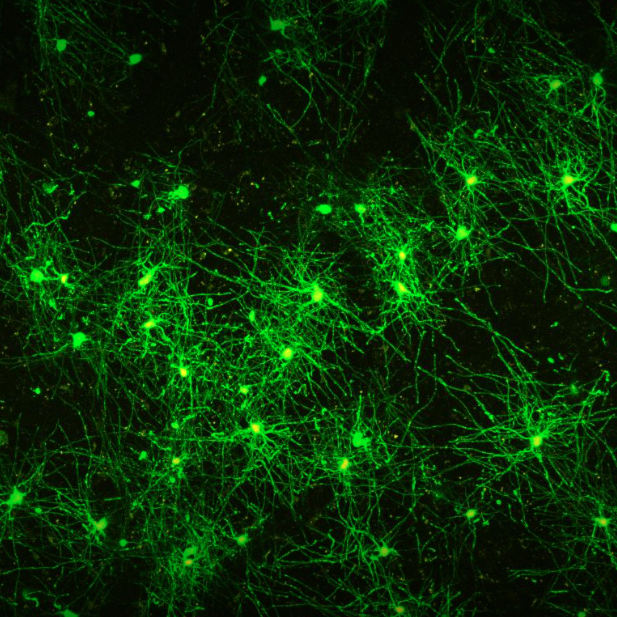 Microscope image of oligodendrocytes; appears as bright green spheres with branches