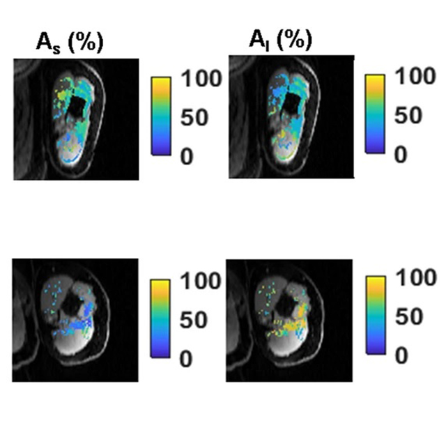 Images show a comparison of muscles before and after hyaluronidase injection.