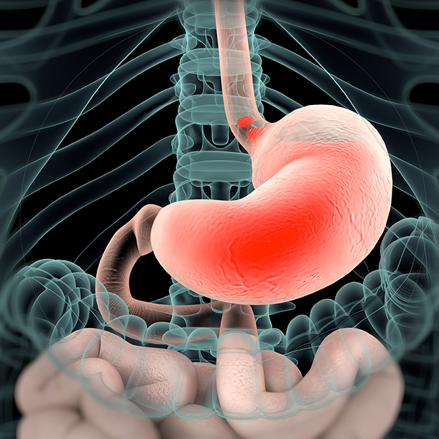 A medical image shows an x-ray view of the intestines with the stomach in red