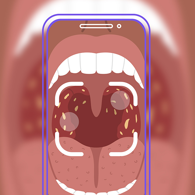 An illustration represents software to diagnose strep throat.  