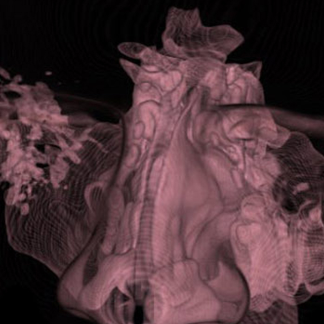 A scan shows the temporal bones.