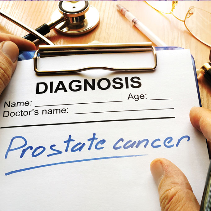 prostate cancer diagnosis on clipboard