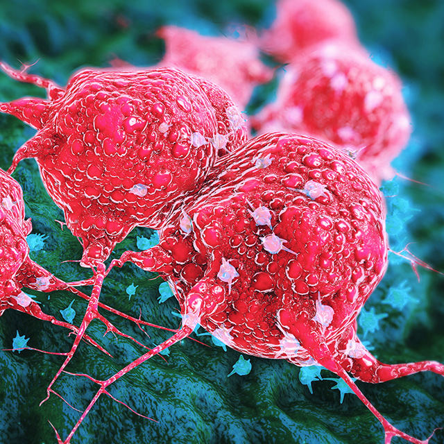 A 3D illustration of cancer cells shows pink spherical masses latching onto a green surface.