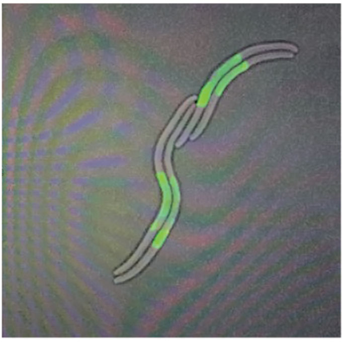 ecoli
