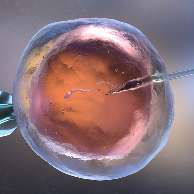 A 3D illustration of artificial semination or in vitro fertilization shows sperm entering an egg from a needle