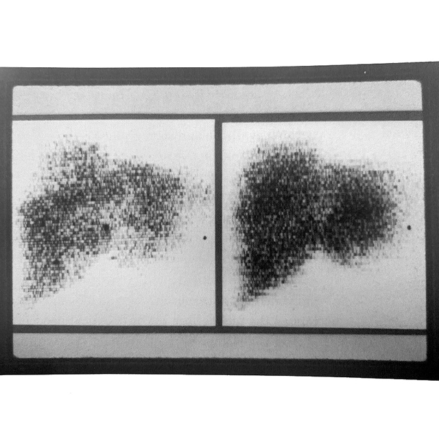 early scan of liver