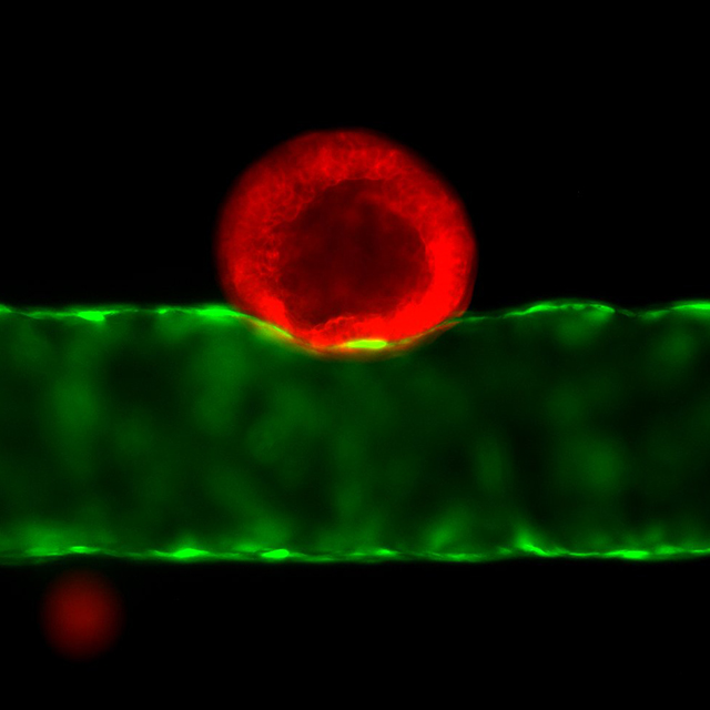 Blood vessels act like highways for tumor cells to metastasize. Here, a tumor organoid (red) is growing near an artificial microvessel (green).