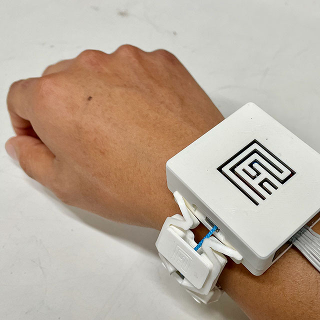 Photo shows a white plastic square device around a person’s wrist, with wires running up the arm