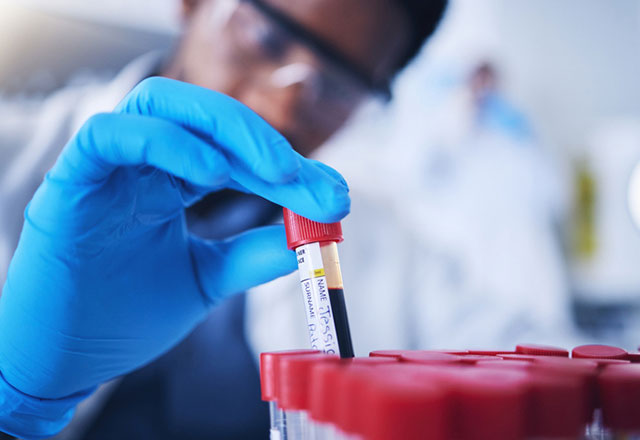 blood samples in lab