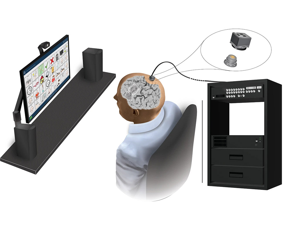 ALS brain-computer interfaces (BCIs)