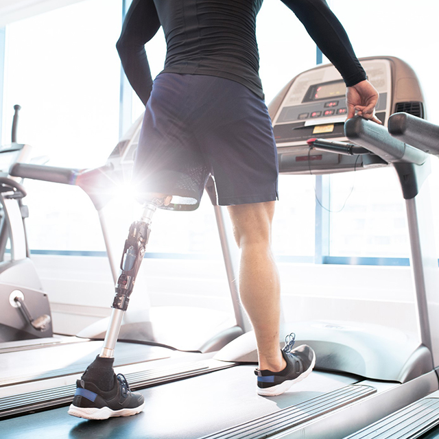 A man with a prosthetic leg runs on a treadmill. 