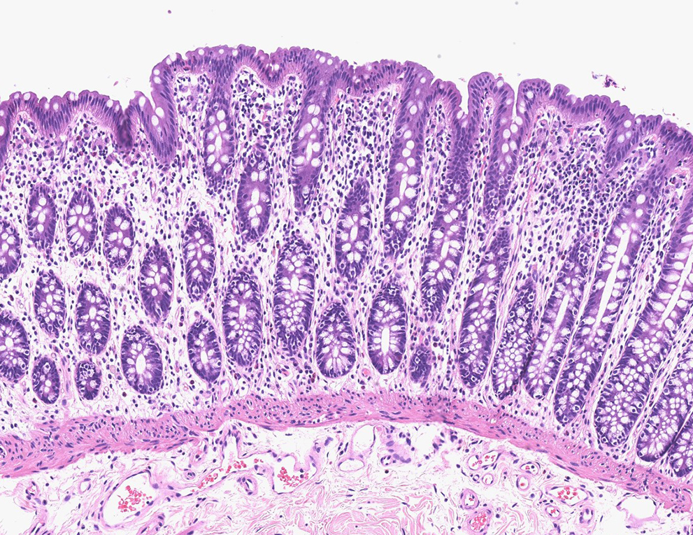 An image of gastrointestinal mucosa