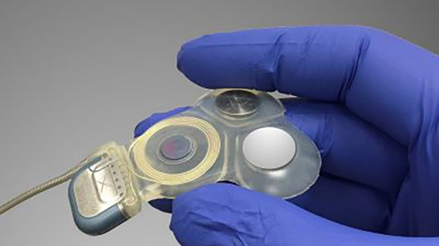 multichannel vestibular implant (MVI)