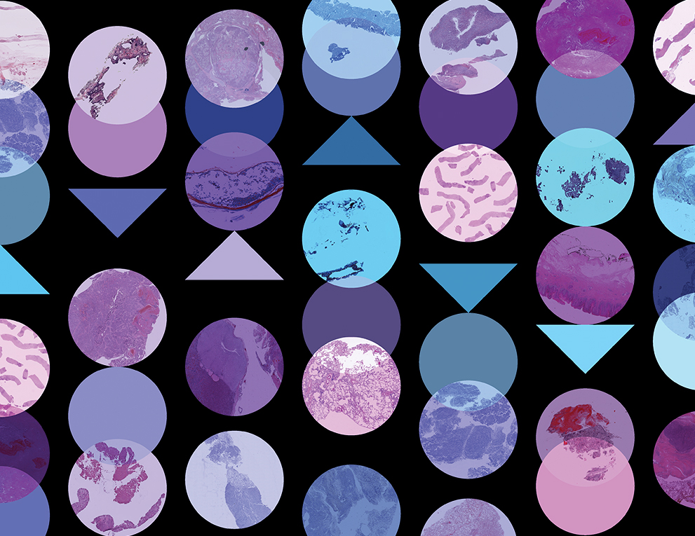 illustration of cancer slides