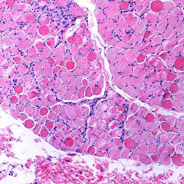 A microscopic view of a membrane