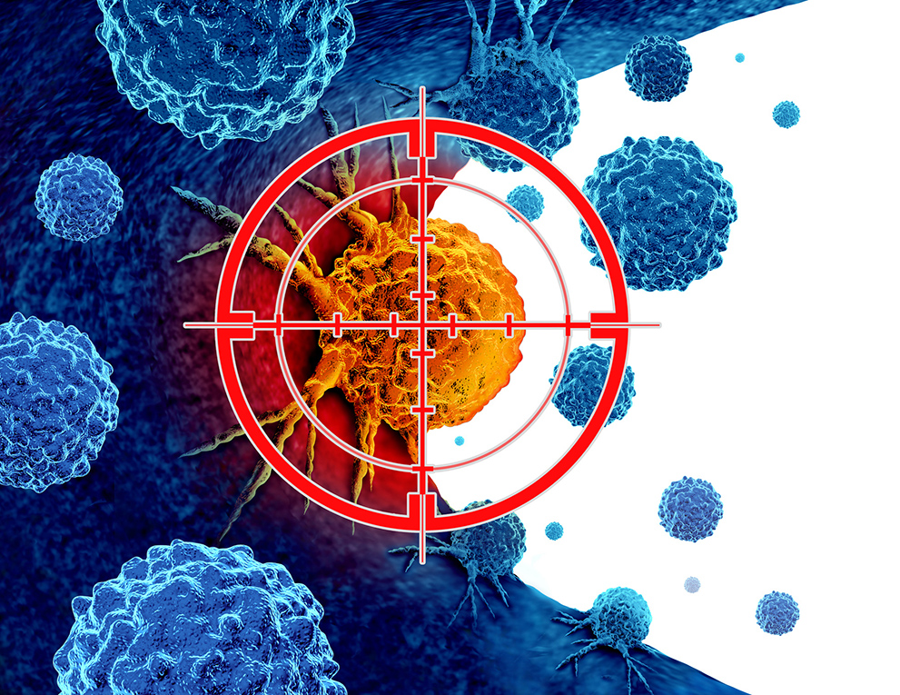 prostate cancer cells