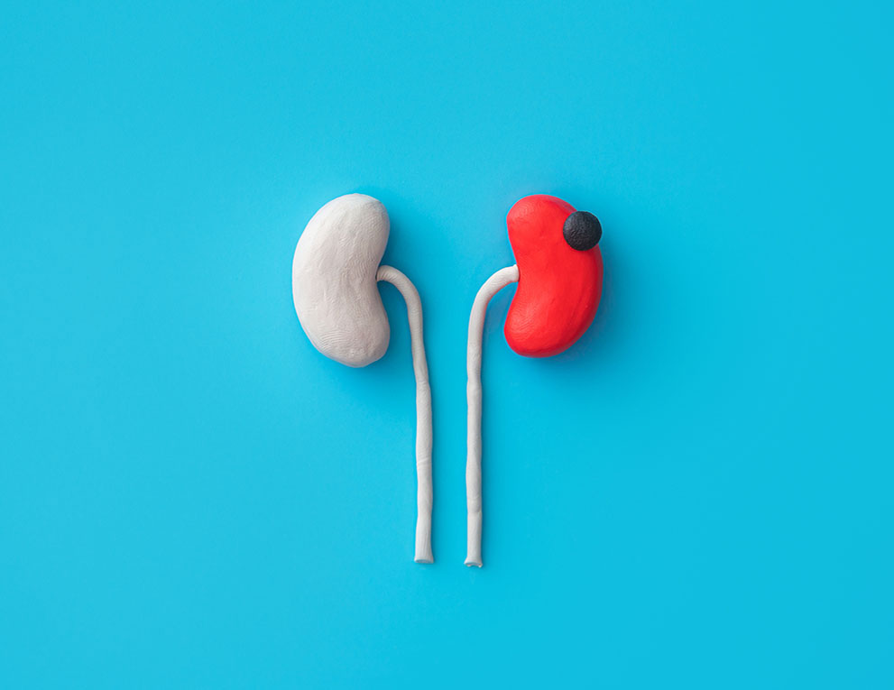 kidneys graphic
