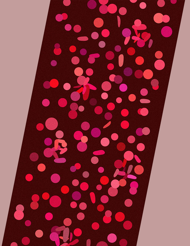 Illustration of sickle cells