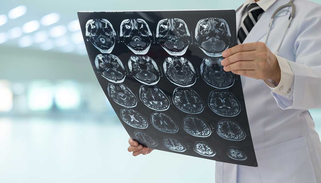 A doctor in a white coat and stethoscope examines brain MRI scans. The setting is a brightly lit hospital, conveying a sense of professionalism and focus.